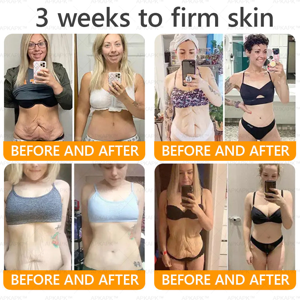 Vyrobené a dodané z USA ✨ APKAPK® Komplexný krém s včelím jedom💫 POSLEDNÝ DEŇ ZĽAVA 80%