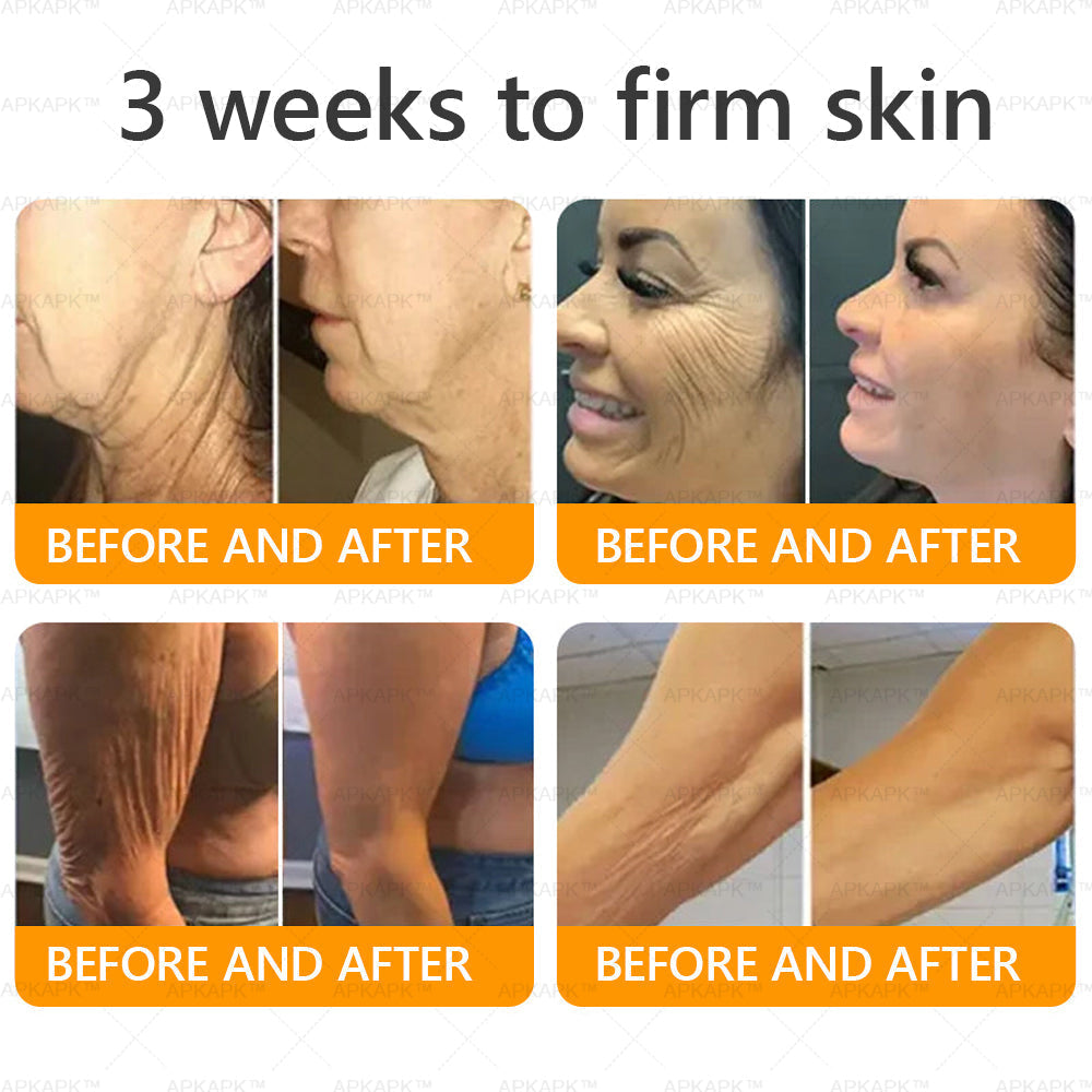 Vyrobené a dodané z USA ✨ APKAPK® Komplexný krém s včelím jedom💫 POSLEDNÝ DEŇ ZĽAVA 80%