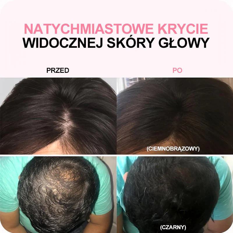 【💰50% zľava pri kúpe 2 kusov】Vlasový prášok (pre všetky farby vlasov)🔥