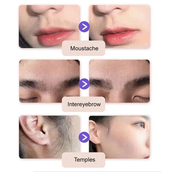 ✨Jemný a bezbolestný krém na odstraňovanie chĺpkov na tvári