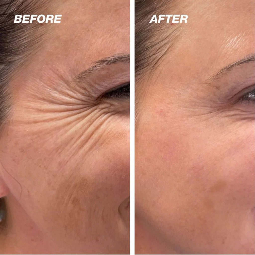 Horúci výpredaj 50% ZĽAVA - HOOMWELL™ Vita A Retinal Shot Spevňujúci posilňovač sietnice