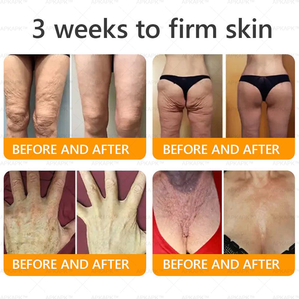 Vyrobené a dodané z USA ✨ APKAPK® Komplexný krém s včelím jedom💫 POSLEDNÝ DEŇ ZĽAVA 80%