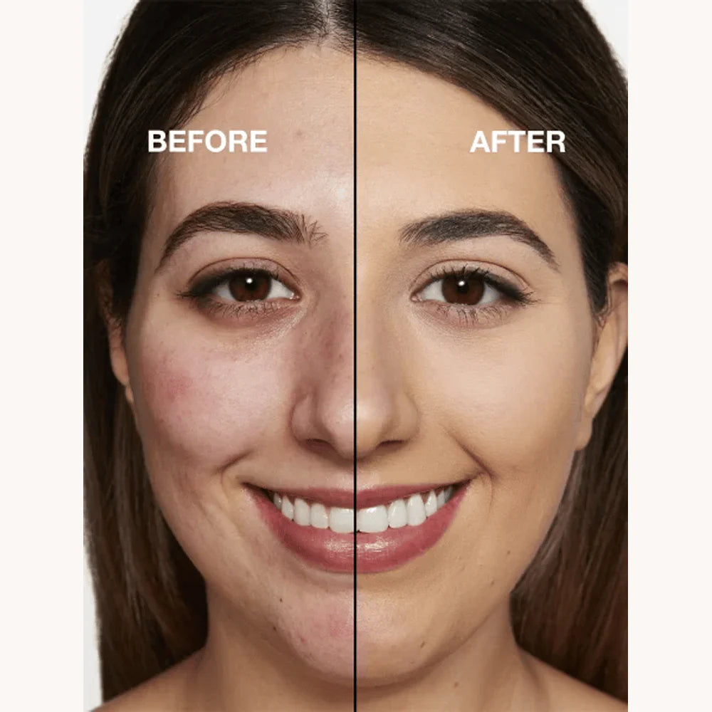 Foundation 4 v 1 - Stredné spektrum