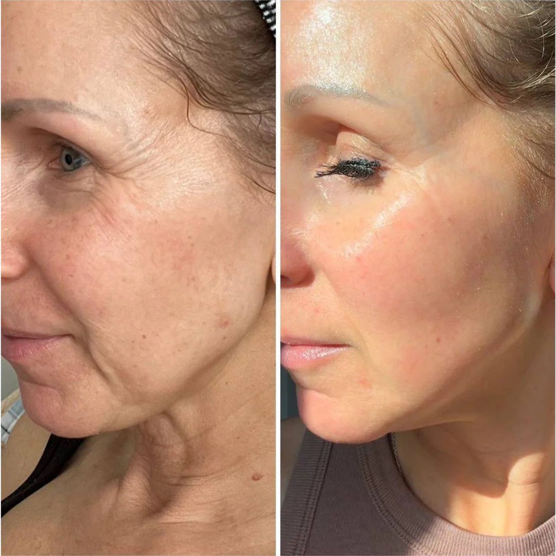 Horúci výpredaj 50% ZĽAVA - HOOMWELL™ Vita A Retinal Shot Spevňujúci posilňovač sietnice